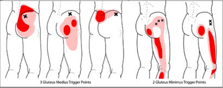 https://www.atxortho.com/wp-content/uploads/2017/12/Hip-Pain.png