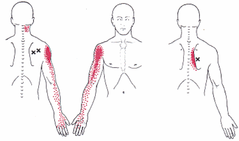 rotator pain 2